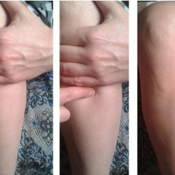 Точка от 100 болезней.